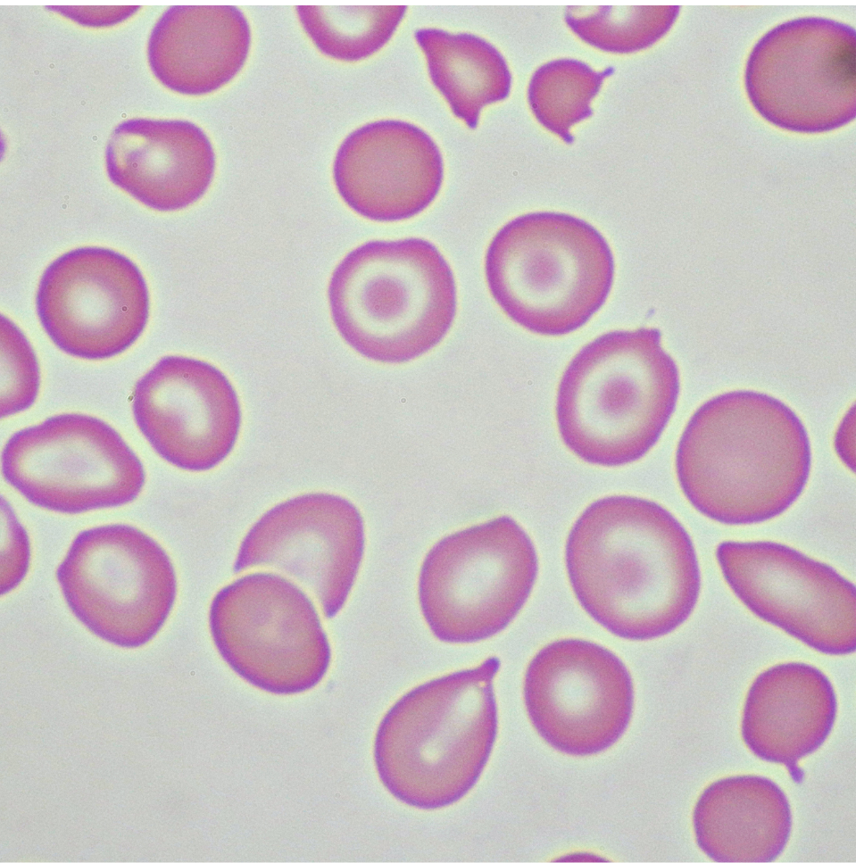 Fructooligosaccharides